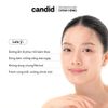 Gel Làm Sạch Tế Bào Chết Candid BHA Gel Exfoliant 100ml