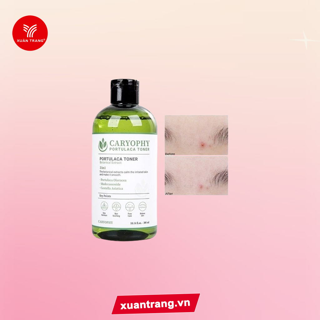 CARYOPHY_Nước Hoa Hồng Ngừa Mụn Kiềm Dầu Portulaca Toner 300ml