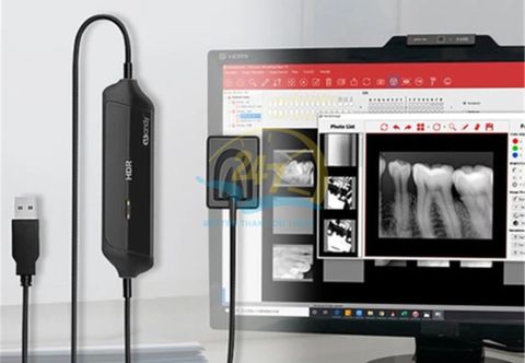 Sensor Nha Khoa Handy HDR 500A – Chính Xác, Hiệu Quả, Chính Hãng