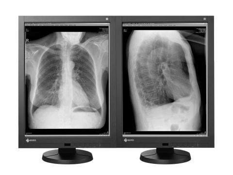 Eizo Radiforce GX240 21