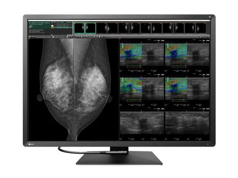 Eizo Radiforce RX1270 12MP 31