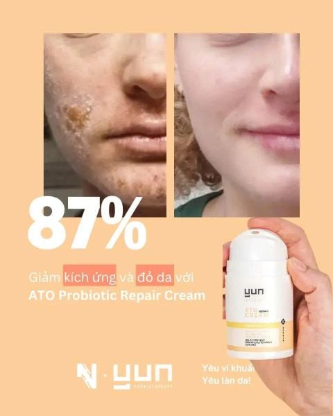Kem làm dịu kích ứng cấp ẩm cho da khô, da nhạy cảm - YUN ATO Probiotic repair cream 50ml