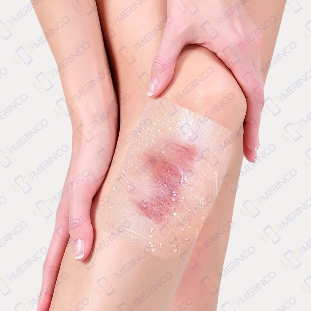 Băng vô trùng không gạc trong suốt không thấm nước Sterile Adflex (Non-Pad) 10cmx12cm