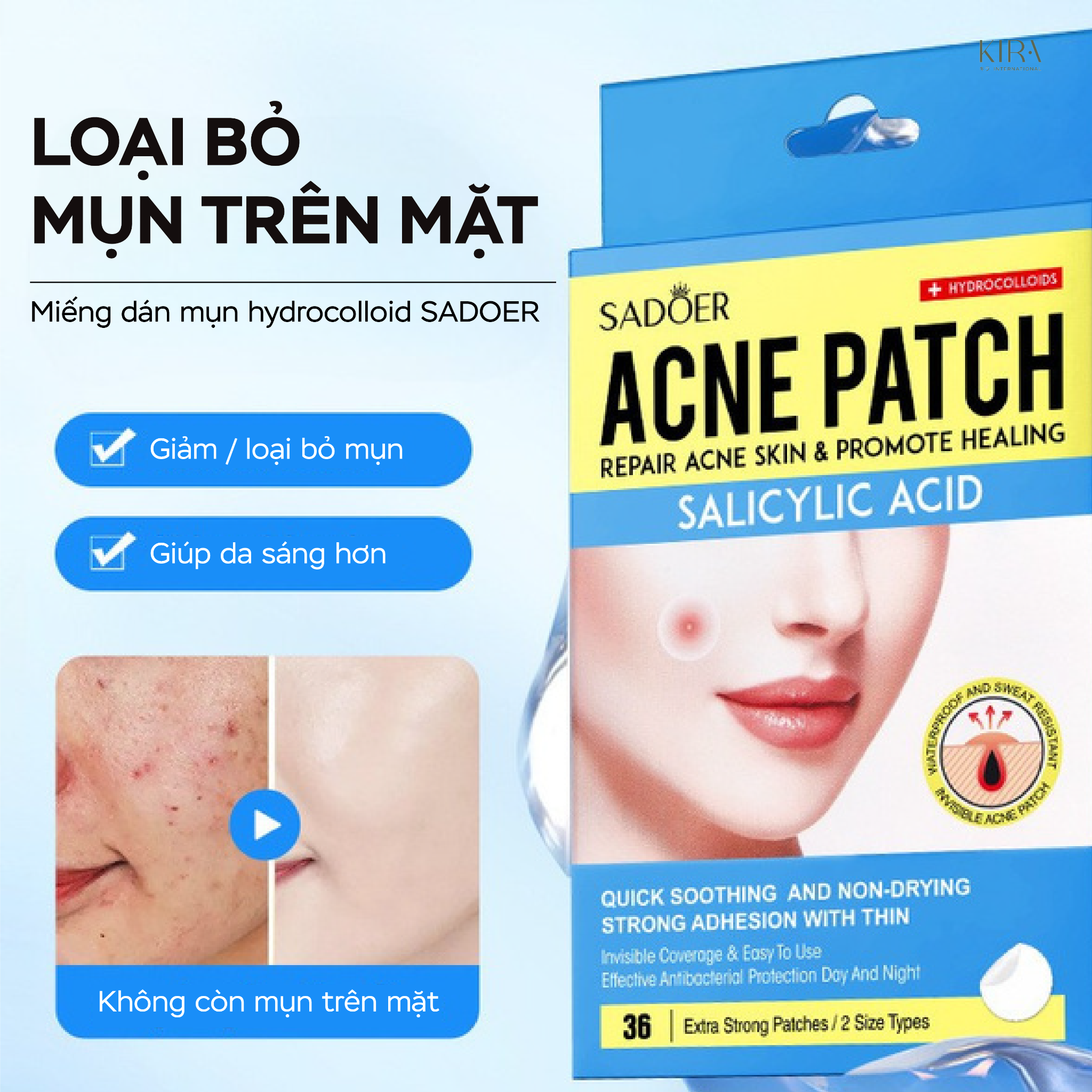  Miếng dán mụn và che khuyết điểm SADOER 