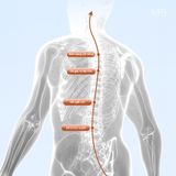  Đai chống gù thông minh cho bé – Bản X có cảm biến rung theo dõi tư thế 