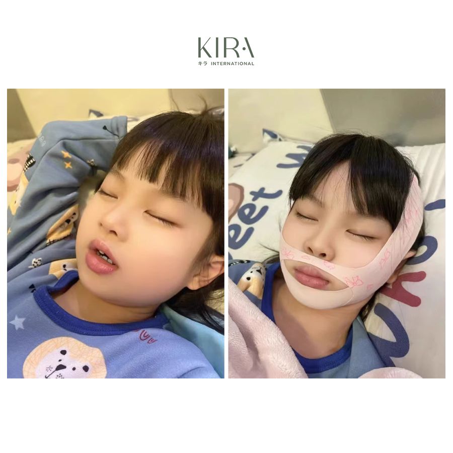  Đai chống ngủ ngáy cho bé 2–7 tuổi | Cố định cằm – Hỗ trợ ngủ ngon, thở dễ dàng 