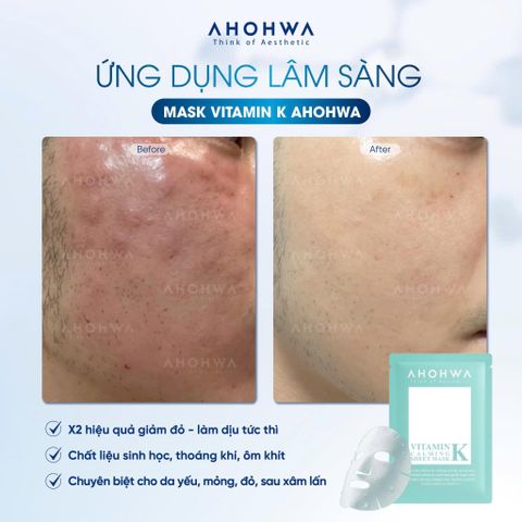  Vitamin K Sheet Mask - Mặt nạ phục hồi sinh học Vitamin K 