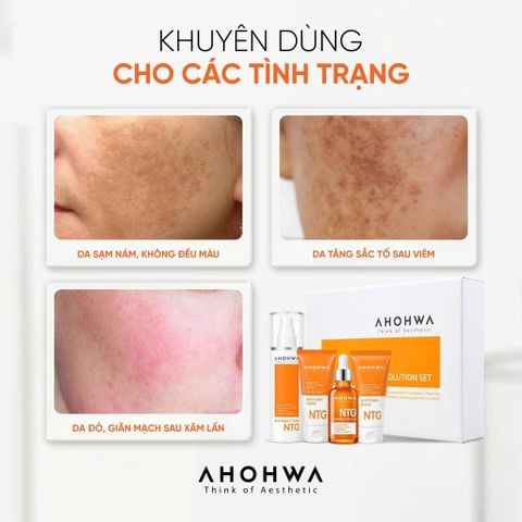  Ahohwa -  NTG White Solution Set - Dưỡng sáng toàn diện, Kiểm soát sắc tố đa tầng 