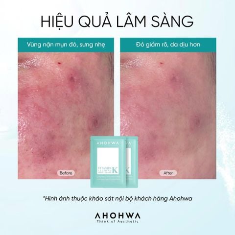  Vitamin K Sheet Mask - Mặt nạ phục hồi sinh học Vitamin K 