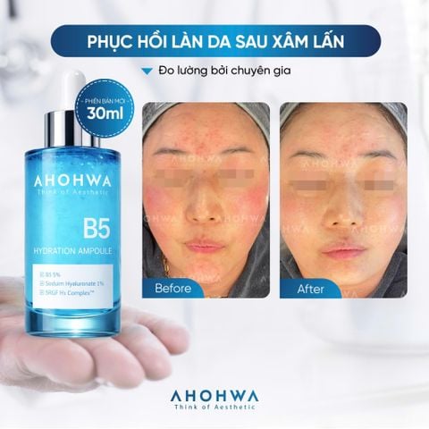  Hydration Ampoule B5 - Tinh Chất B5 Hỗ Trợ Cấp Ẩm Và Chăm Sóc Da Khỏe Mạnh - 30ml 