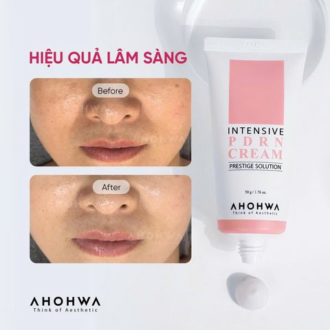  Ahohwa - Intensive PDRN Cream - Kem tái thiết làn da nguyên bản, phục hồi trẻ hóa cấp độ tế bào 