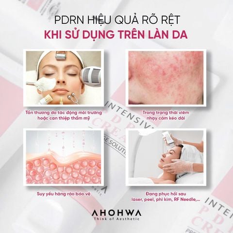  Ahohwa - Intensive PDRN Cream - Kem tái thiết làn da nguyên bản, phục hồi trẻ hóa cấp độ tế bào 
