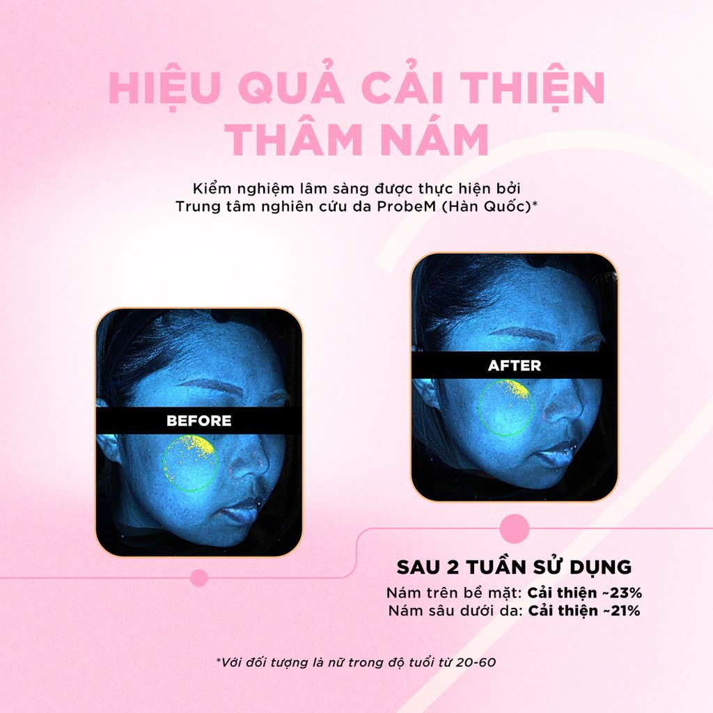 Kem Dưỡng Trắng da LANCI Bật Tông Trắng Mướt 15ml