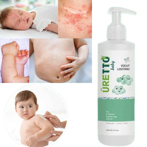 Sữa dưỡng thể cho bé