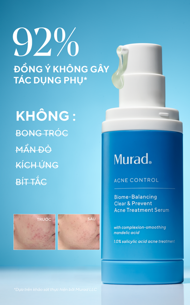 Serum Hỗ Trợ Ngăn Ngừa Mụn Murad Biome-Balancing Clear & Prevent Acne Treatment Serum 30ml