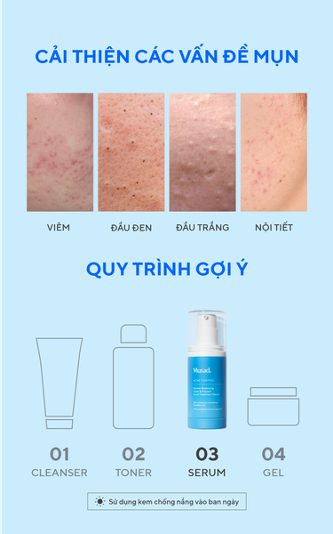 Serum Hỗ Trợ Ngăn Ngừa Mụn Murad Biome-Balancing Clear & Prevent Acne Treatment Serum 30ml