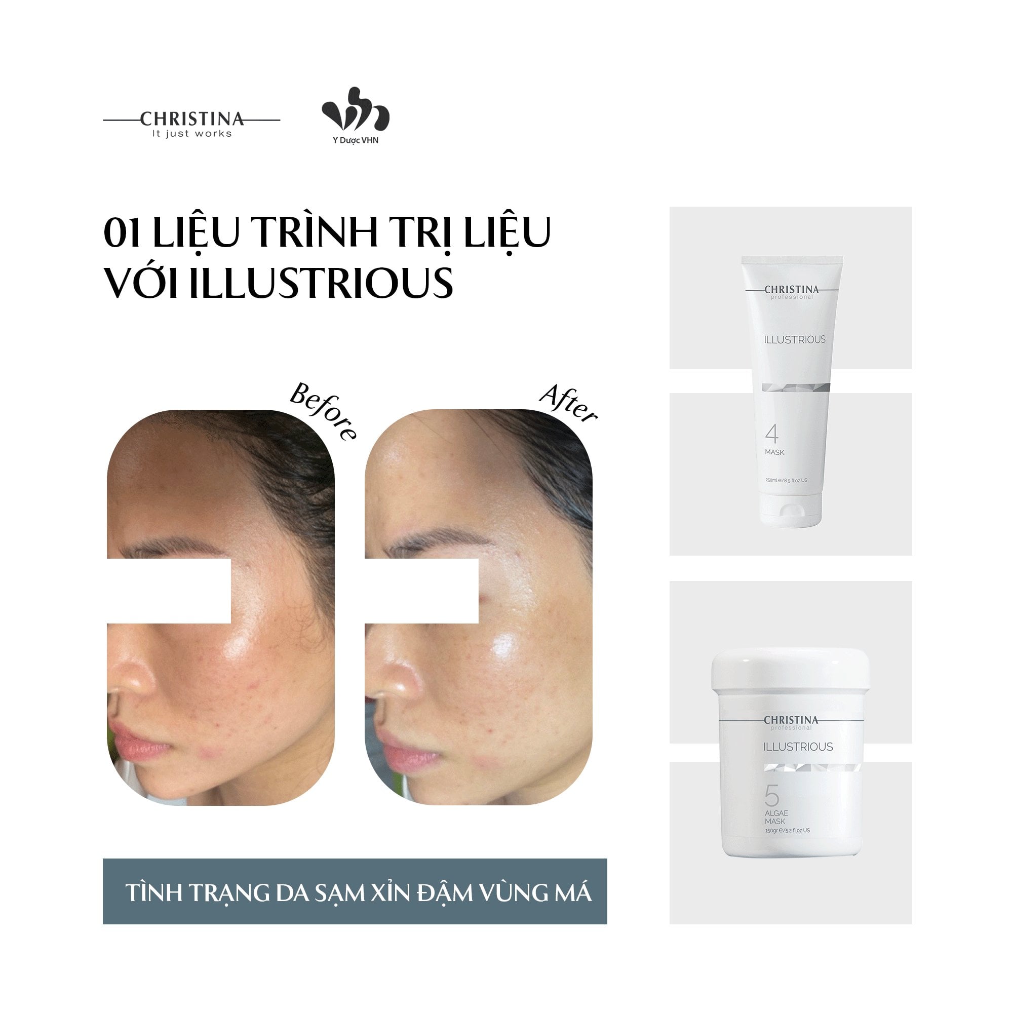 Mặt nạ tảo Christina Illustrious 5 Algae Mask Hỗ Trợ Trắng Sáng Da Và Căng Bóng Da 150ml