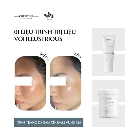 Mặt nạ tảo Christina Illustrious 5 Algae Mask Hỗ Trợ Trắng Sáng Da Và Căng Bóng Da 150ml