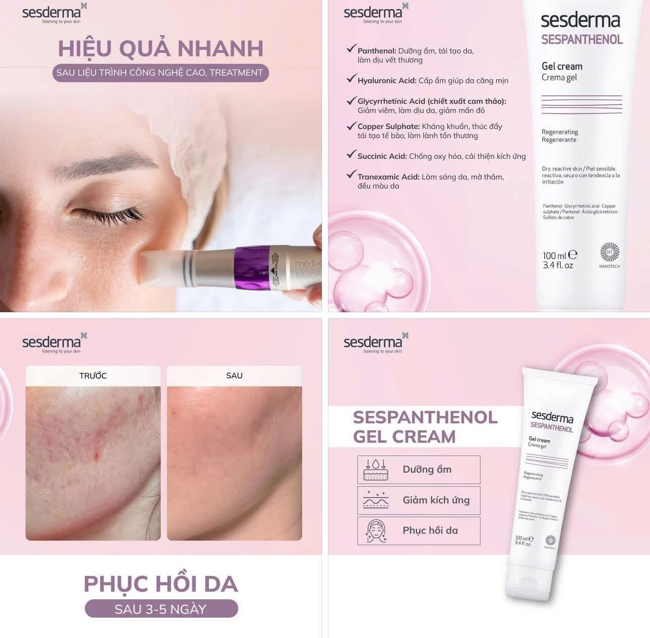 Sesderma Sespanthenol Gel Cream 100ml – Gel Làm Dịu, Giảm Kích Ứng & Phục Hồi Da Cấp Tốc