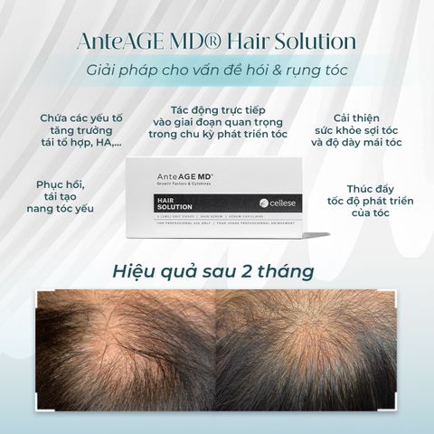 AnteAGE MD Hair Solution - Tinh Chất Giảm Rụng Và Kích Thích Mọc Tóc