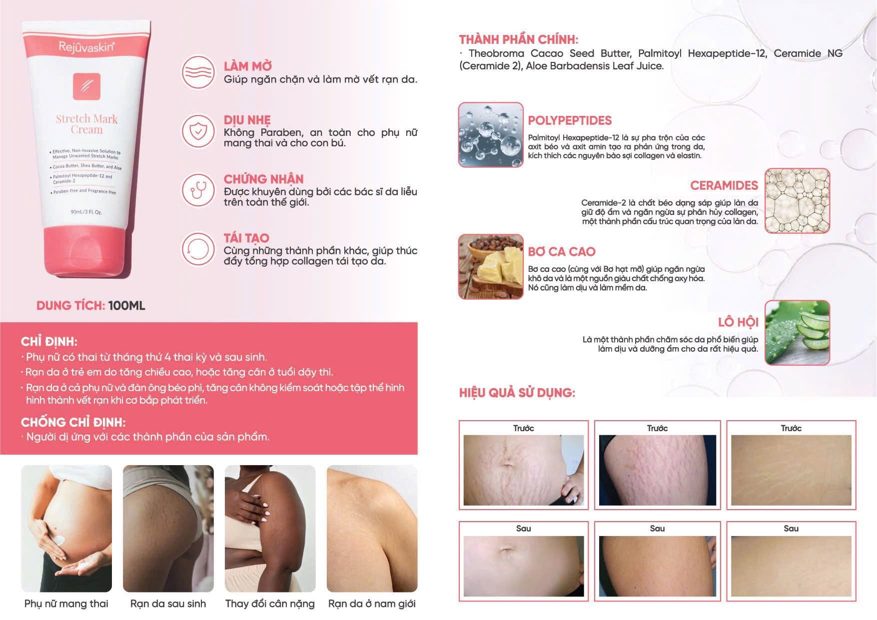 Rejuvaskin Stretch Mark Cream - Kem phòng ngừa và làm mờ rạn da 90ml