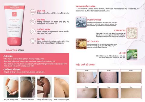 Rejuvaskin Stretch Mark Cream - Kem phòng ngừa và làm mờ rạn da 90ml