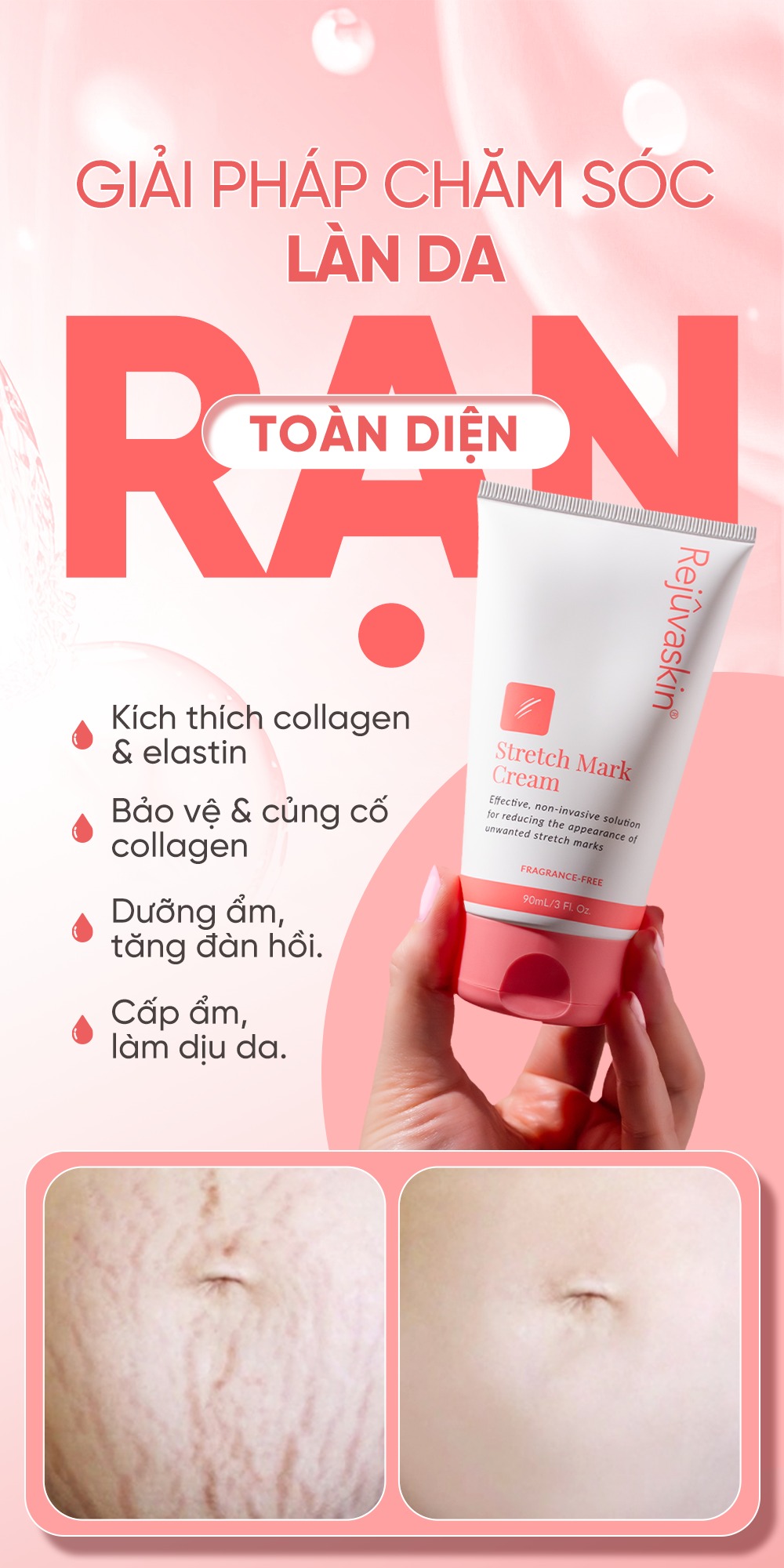 Rejuvaskin Stretch Mark Cream - Kem phòng ngừa và làm mờ rạn da 90ml