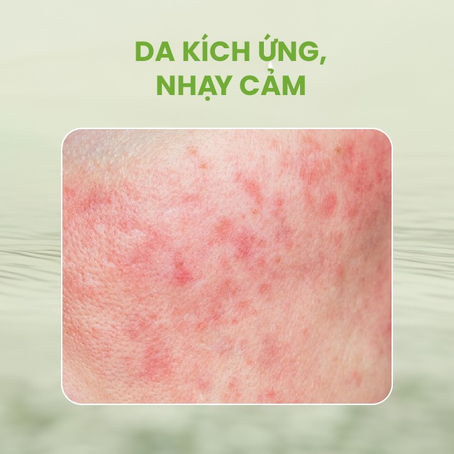 Sesderma Hidraloe Aloe Gel 250ml – Gel Lô Hội Làm Dịu & Phục Hồi Da Nhanh