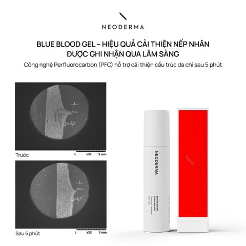 Neoderma Blue Blood Gel Youth Infuser - Gel tái tạo, khôi phục hàng rào bảo vệ & trẻ hóa da