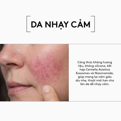 Verso Super Exo Soothe Serum - Tinh Chất Cấp Ẩm Làm Dịu 30ml