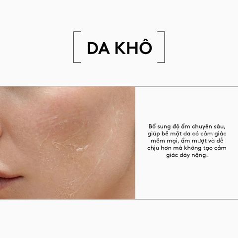 Verso Super Exo Soothe Serum - Tinh Chất Cấp Ẩm Làm Dịu 30ml