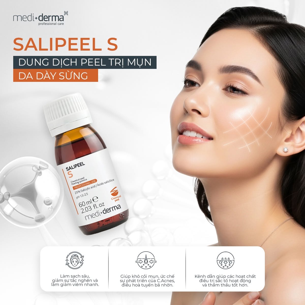 Mediderma Salipeel S Dung Dịch Peel Giảm Mụn, Da Dày Sừng