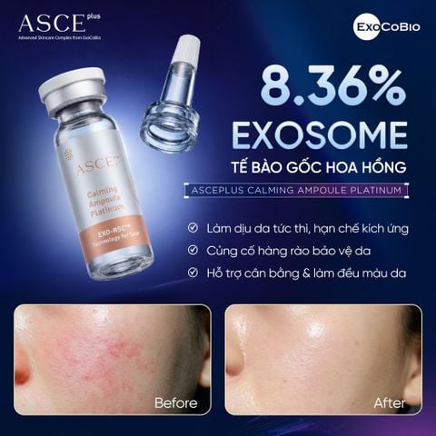 ASCE plus Calming Ampoule Platinum Tinh Chất Làm Dịu Phục Hồi Da Exosome Hộp 5 ống x 3.5ml