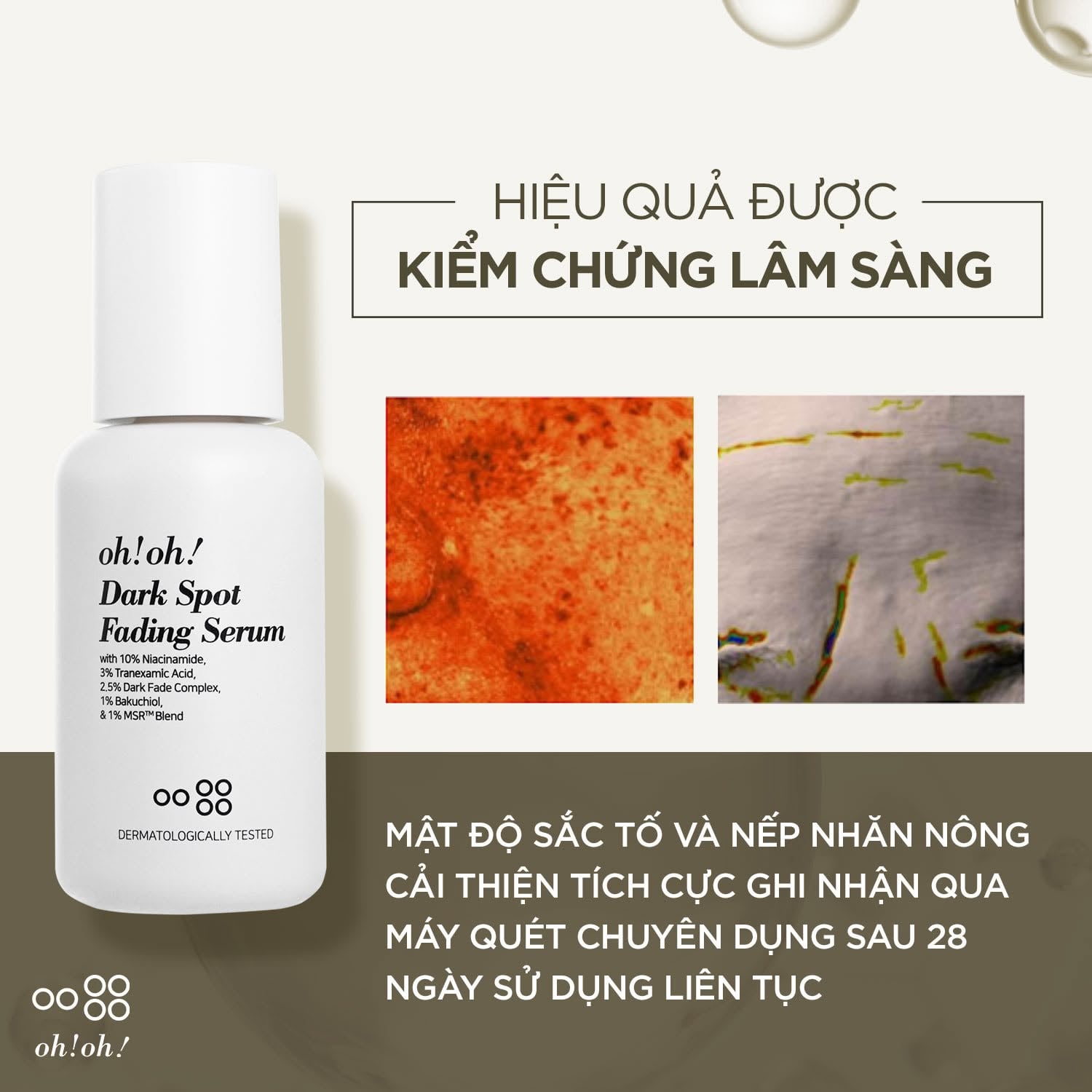 Oh!oh! Dark Spot Fading Serum 30ml - Tinh Chất Kiểm Soát Sắc Tố Toàn Diện & Chống Lão Hóa 30ml