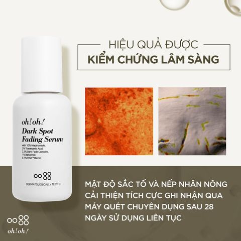 Oh!oh! Dark Spot Fading Serum 30ml - Tinh Chất Kiểm Soát Sắc Tố Toàn Diện & Chống Lão Hóa 30ml