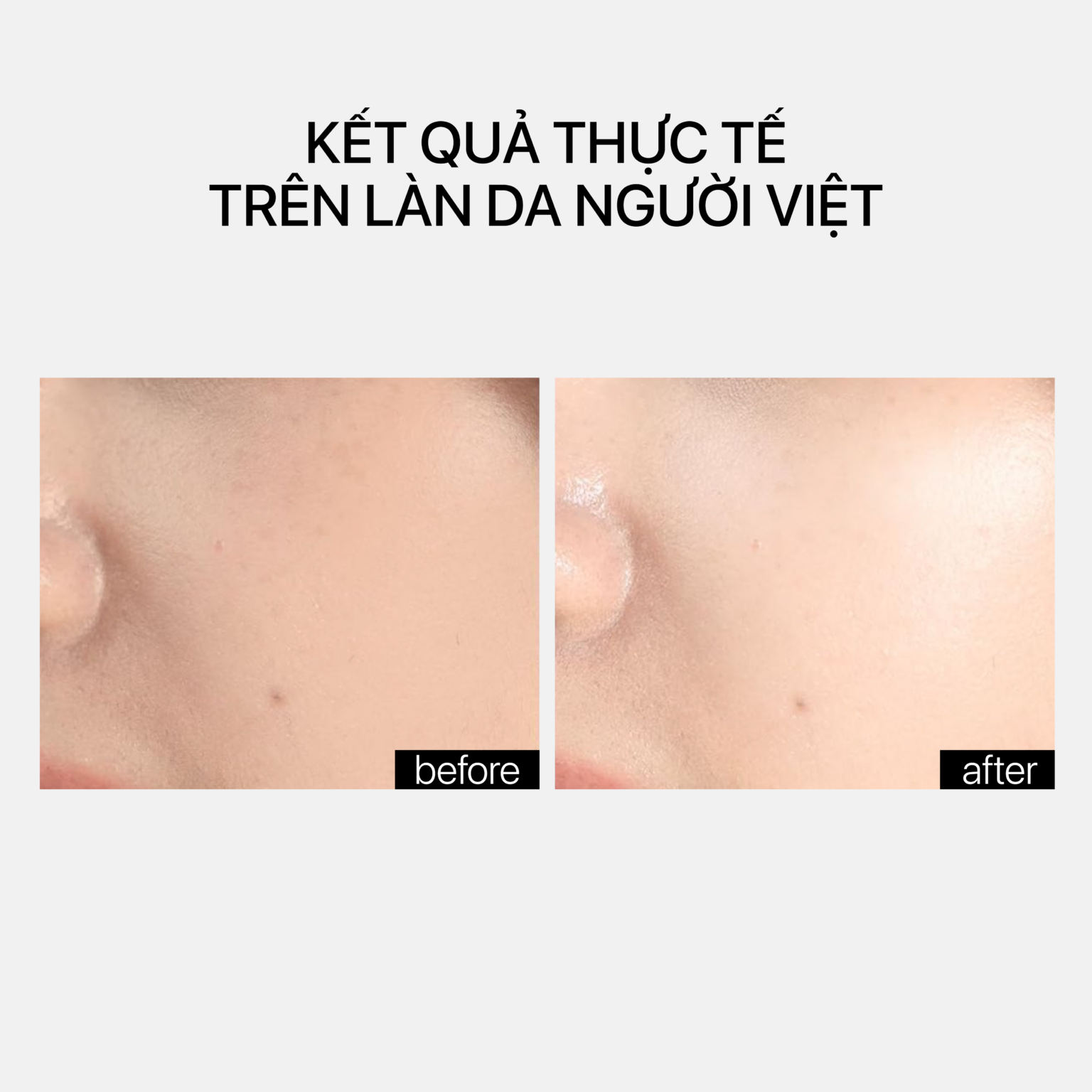 Theramid Hapca Filler -  Tinh Chất HA Cấp Ẩm Đa Tầng, Làm Mịn & Căng Bóng Da 30ml