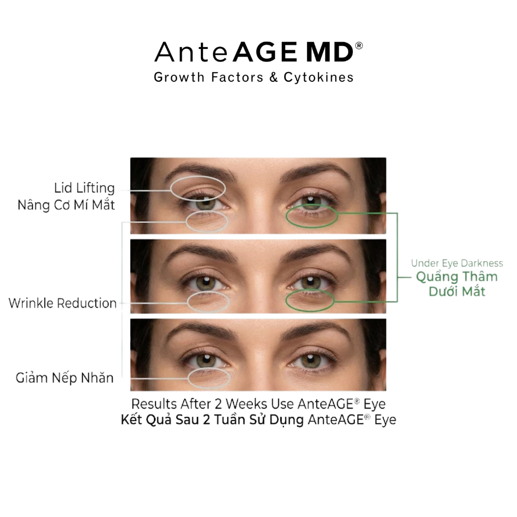 AnteAGE EYE Reset Biosomes - Kem Mắt  Hỗ Trợ Giảm Bọng, Thâm, Nếp Nhăn Vùng Mắt 15ml