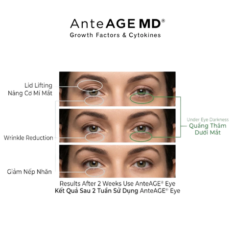 AnteAGE EYE Reset Biosomes - Kem Mắt  Hỗ Trợ Giảm Bọng, Thâm, Nếp Nhăn Vùng Mắt 15ml