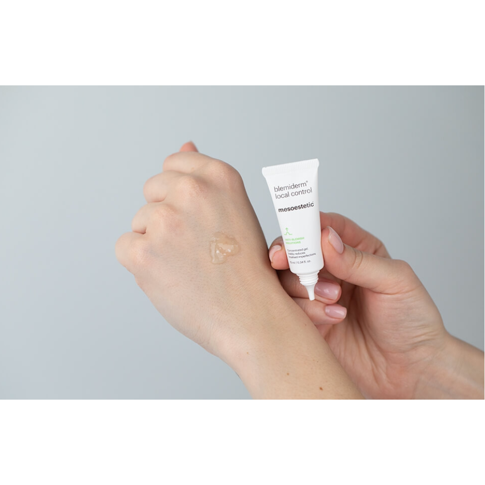 Mesoestetic Blemiderm Local Control Chấm Mụn Hỗ Trợ Giảm Viêm, Gom Cồi 10ml