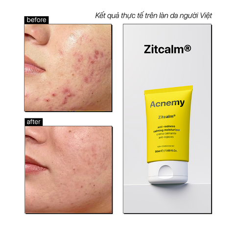Acnemy Zitcalm Anti Redness Calming Moisturizer Kem Dưỡng Làm Dịu Da Và Hỗ Trợ Phục Hồi Da 50ml