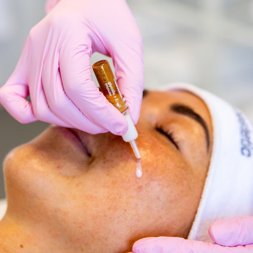 Mesoestetic Glycolic + E + F Ampoules Tinh Chất Tái Tạo Và Hỗ Trợ Làm Sáng Da 10x2ml