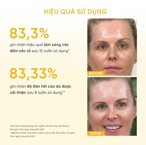 M. Asam 10% Vitamin C Serum Intense Tinh Chất Dưỡng Sáng Đều Màu Da 30ml