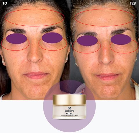 Sesderma Retisil Intensive Pro-Aging Cream 50ml – Kem Dưỡng HPR Giảm Nếp Nhăn, Chống Lão Hóa, Làm Mịn Da