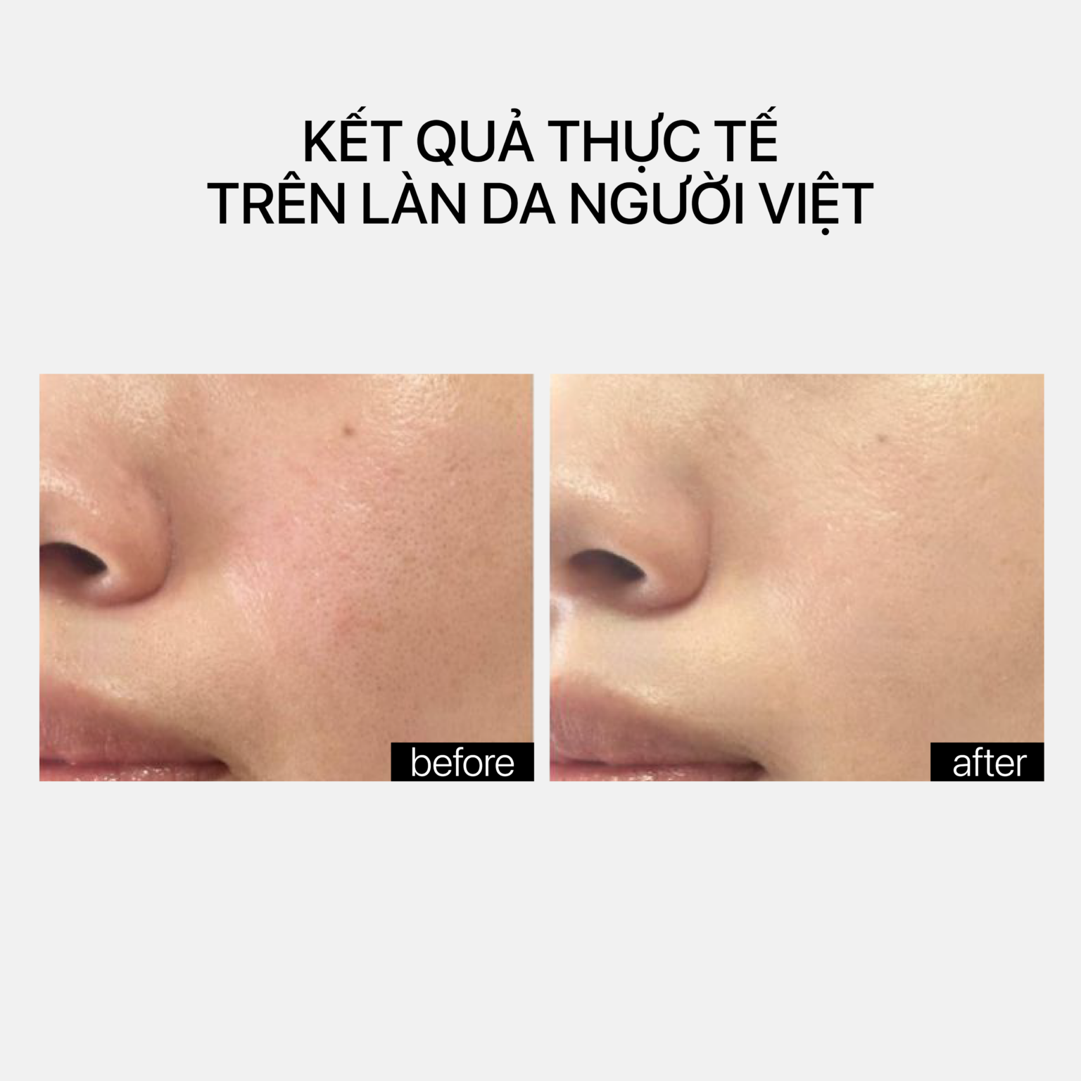 Theramid Clinical Vitamin A - Tinh Chất Vitamin A Tái Tạo Da Chuyên Sâu, Cải Thiện Kết Cấu Da 30ml