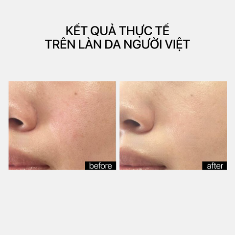 Theramid Clinical Vitamin A - Tinh Chất Vitamin A Tái Tạo Da Chuyên Sâu, Cải Thiện Kết Cấu Da 30ml