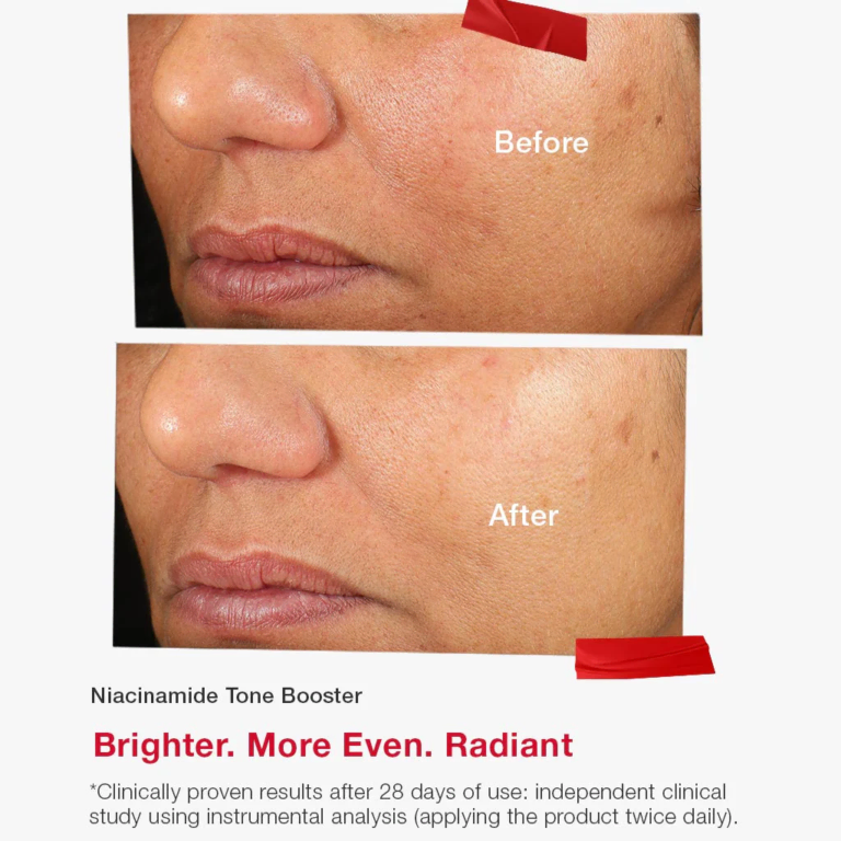 Skincode Niacinamide Tone Booster - Tinh chất Niacinamide 10% - trắng sáng, nâng tone rạng rỡ và làm đều màu da 30ml