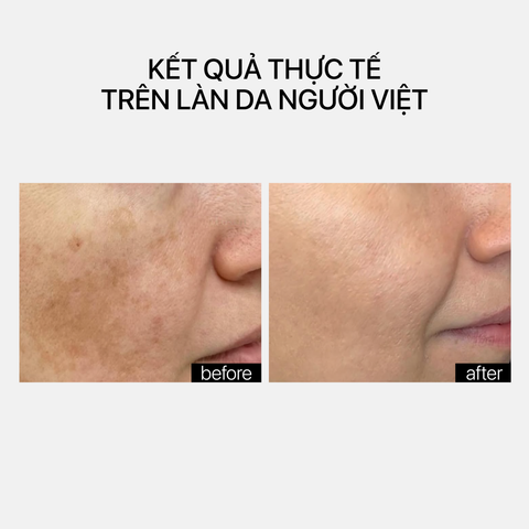 Theramid Tetramid C.E.F - Tinh Chất Chống Oxy Hóa & Làm Sáng Da Thế Hệ Mới 30ml