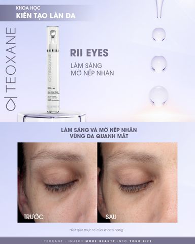 Teoxane R[II] Eyes - Kem Mắt  Chống Lão Hóa, Giảm Quầng Thâm & Bọng Mắt 15ml