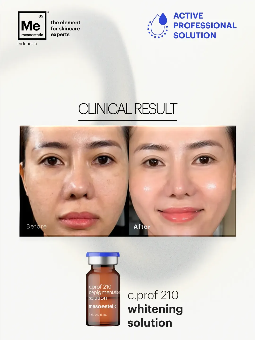 Mesoestetic C.Prof 210 Depigmentation Solution - Tinh Chất Hỗ Trợ Làm Sáng Da, Cải Thiện Sắc Tố 5x5ml