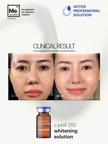Mesoestetic C.Prof 210 Depigmentation Solution - Tinh Chất Hỗ Trợ Làm Sáng Da, Cải Thiện Sắc Tố 5x5ml